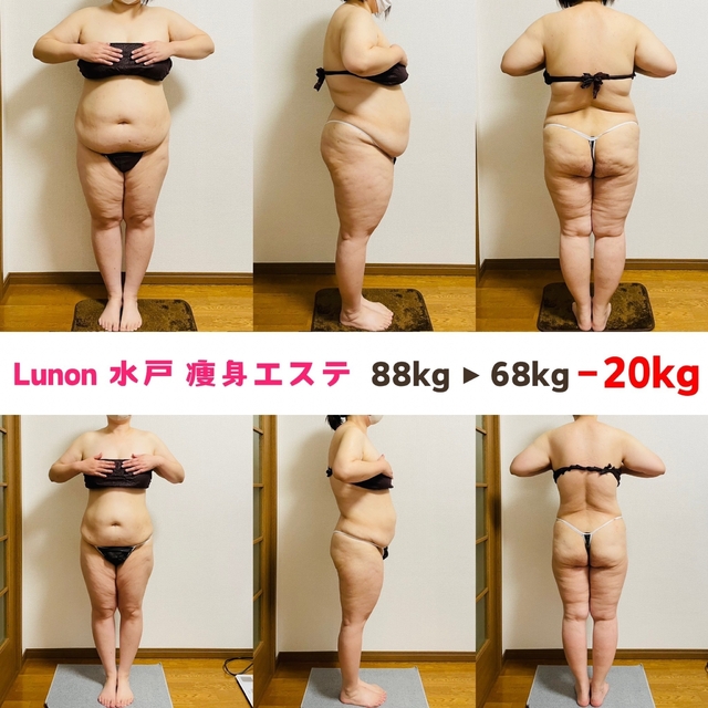 ダイエット専門エステサロン Lunon ～ルノン～