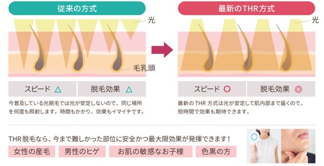 メンズ脱毛ゼーブル つくば店 メニュー3 つくば市竹園 メンズ脱毛 メンズエステ いばナビ