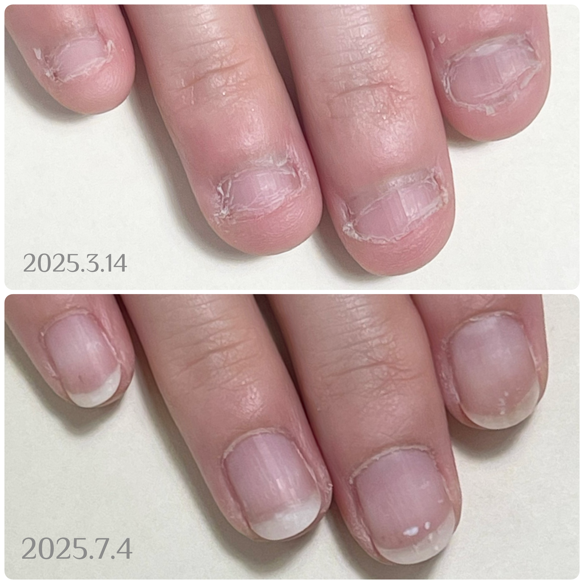 深爪矯正・美人爪育成ネイルサロン リッカ