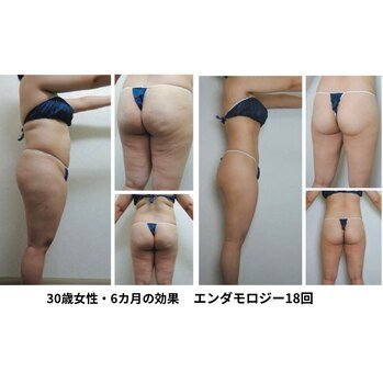 ローゼル花美容痩身 美と健康と痩身サロン Maria Rose -マリアローズ-[水戸市/エステサロン
